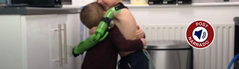 Menino de 5 anos ganha prótese de braço feita em impressora 3D e abraça irmão pela primeira vez